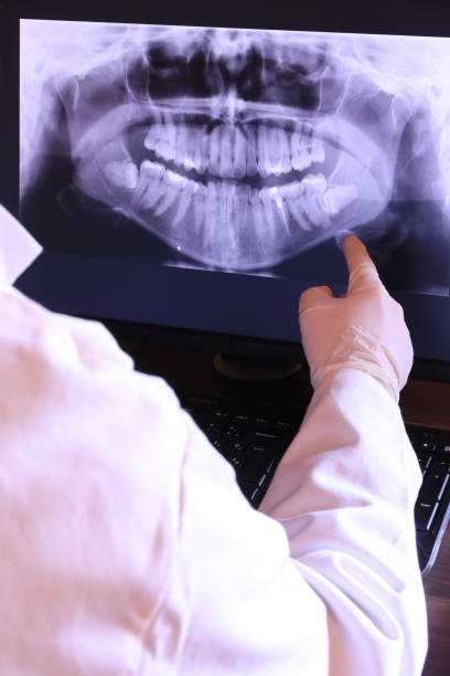 Best Emergency Root Canal Therapy in Bellevue, NE