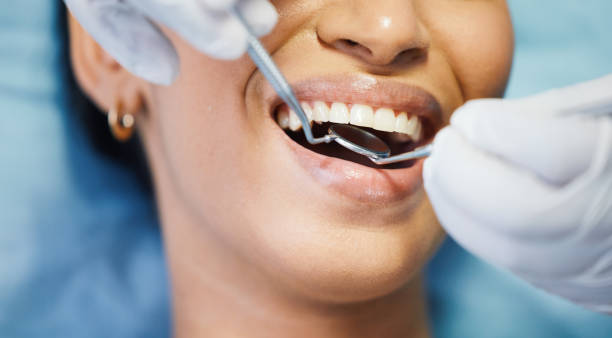 Best Emergency Dental Care for Sports Injuries in Bellevue, NE