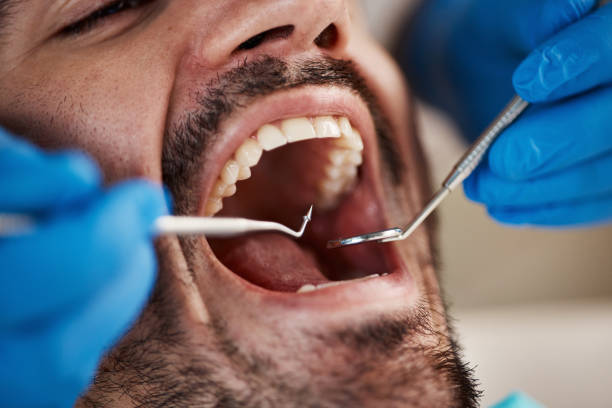 Best Emergency Orthodontic Repairs in Bellevue, NE
